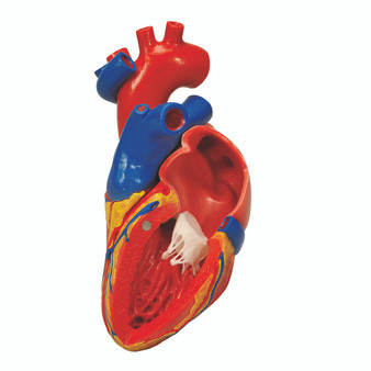 Anatomical Heart Model, 2-Part with Bypass | 3B Smart Anatomy Included