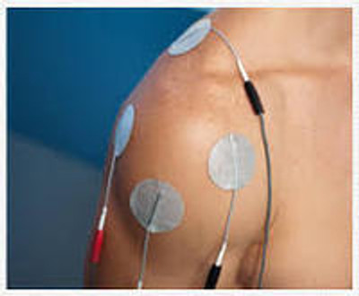 Example of transdermal electric muscle stimulation by means of a