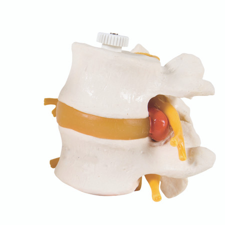 Flexible Mount, 2 Lumbar Vertebrae Model, 3B Smart Anatomy