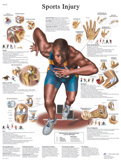 Anatomical Chart - Common Sports Injuries chart, laminated Anatomical Chart - Common Sports Injuries chart, laminated