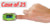 Baseline Pediatric (kids) Fingertip Pulse Oximeter, Case of 25 Baseline Pediatric (kids) Fingertip Pulse Oximeter, Case of 25