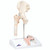 Anatomical Hip Model – Fractured Femur and Hip Osteoarthritis, 3B Smart Anatomy Anatomical Hip Model – Fractured Femur and Hip Osteoarthritis, 3B Smart Anatomy
