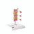 3 Vertebrae Deluxe Osteoporosis Model, 3B Smart Anatomy
