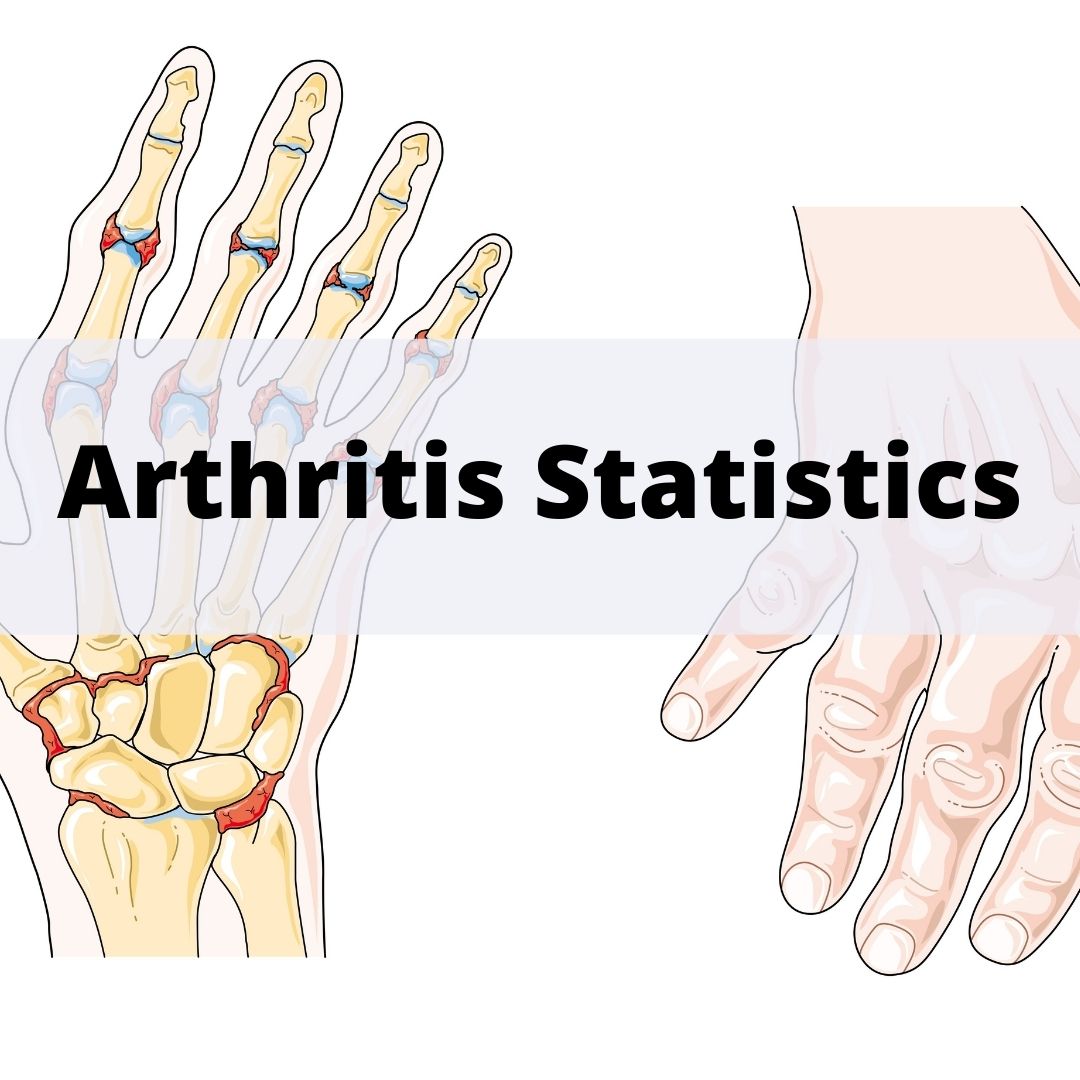 arthritis-statistics-prohealthcareproducts.jpg