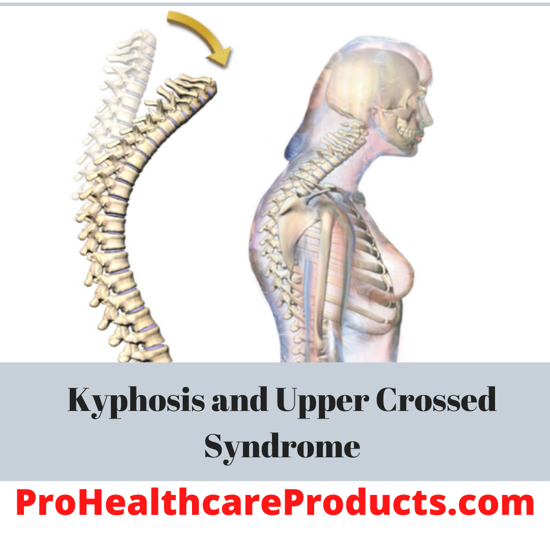 Kyphosis and Upper Crossed Syndrome