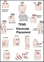 10 Tips For Effective TENS Unit Pad Placement for Pain Relief