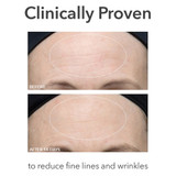 Dr Dennis Gross Skincare Alpha Beta Ultra Gentle Daily Peel 5 Treatments