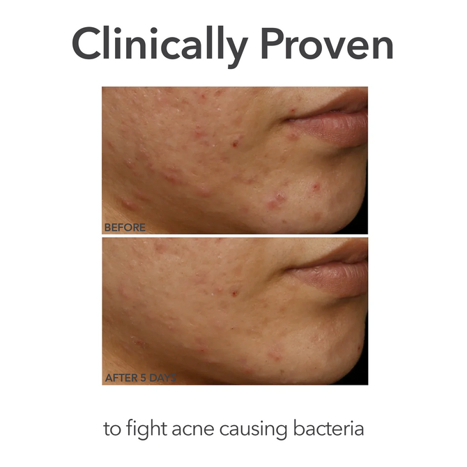 Dr Dennis Gross DRx SpectraLite Faceware Pro Power Pink