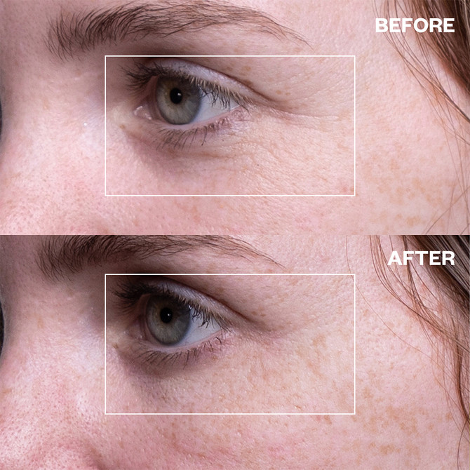 Wrinkles Shminkles Eye Wrinkle Patches - Single One Pair