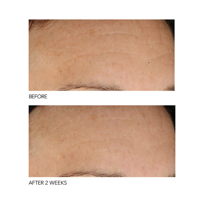 Dr Dennis Gross B3 Adaptive Superfoods Stress Repair Face Cream