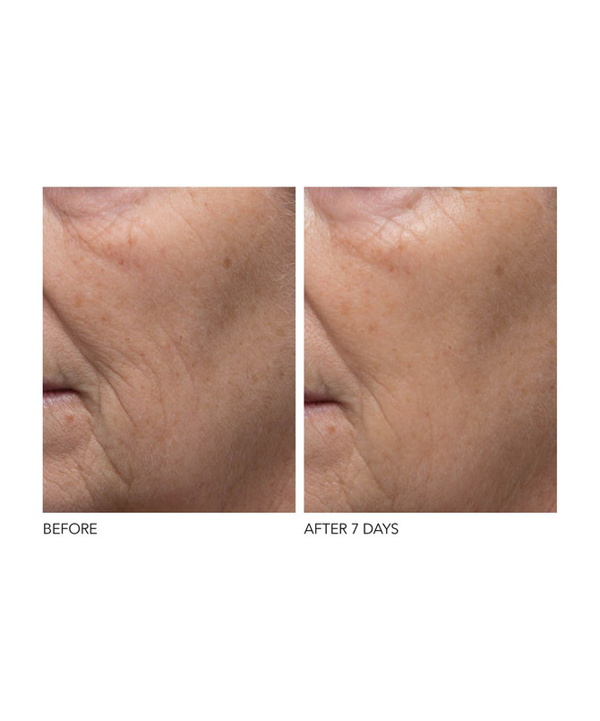 Dr Dennis Gross Alpha Beta Pore Perfecting Moisturizer