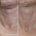 This Works Perfect Cleavage & Neck Serum