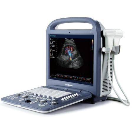 SonoScape S2 Portable Ultrasound System