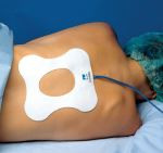 (Discontinued) ConMed 01-3130 ECG Backpads Adult, 1, FM Adgel