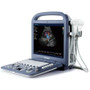 SonoScape S2 Portable Ultrasound System