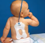 ConMed 01-4130 ECG Bakpads Infant, 1, FM Adgel