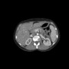 Abdomen Phantom for CT, X-Ray and  Radiation Therapy