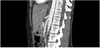 Abdomen Phantom for CT, X-Ray and  Radiation Therapy