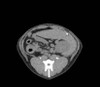 Dog Abdomen- Phantom for CT & Xray