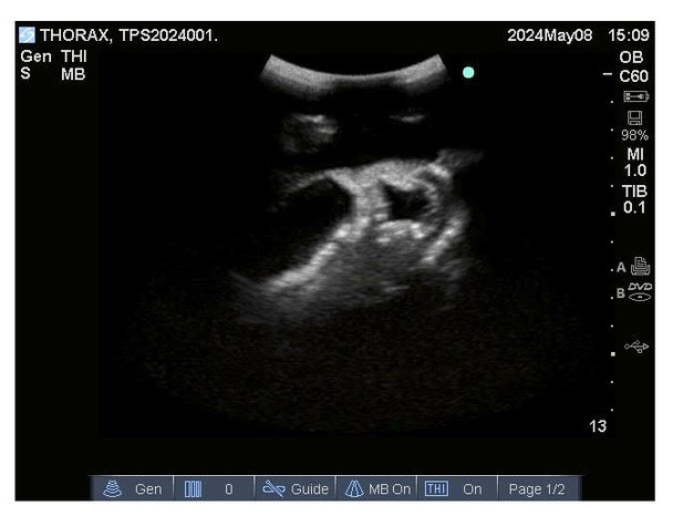 Adult Thorax for X-Ray CT and US, Model FLX02