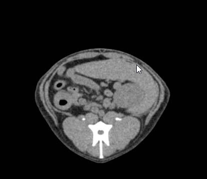 Dog Abdomen- Phantom for CT & Xray