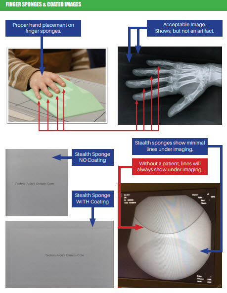 sponge-artifacts.jpg sponge-artifacts.jpg