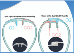 A visual display of the difference between split (bifurcated) and cloud