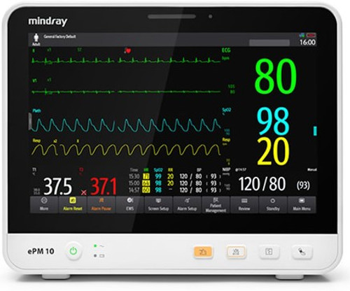 Mindray 12MA ePM - High-resolution image of the Mindray ePM 12MA patient monitor in clinical setting. This touchscreen multi-parameter monitor displays real-time vital signs including ECG, SpO₂, NIBP, and CO₂. Sleek interface with intuitive controls, ideal for oral surgery, sedation dentistry, and hospital workflow optimization. Ergonomic design, vivid display, and Mindray Smart Cable technology enhance procedural efficiency and patient safety. Medical device featured on cart mount with attached accessories—perfect for outpatient clinics and dental sedation monitoring.