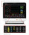 Creen Features of the Mindray 12MA ePM - High-resolution image of the Mindray ePM 12MA patient monitor in clinical setting. This touchscreen multi-parameter monitor displays real-time vital signs including ECG, SpO₂, NIBP, and CO₂. Sleek interface with intuitive controls, ideal for oral surgery, sedation dentistry, and hospital workflow optimization. Ergonomic design, vivid display, and Mindray Smart Cable technology enhance procedural efficiency and patient safety. Medical device featured on cart mount with attached accessories—perfect for outpatient clinics and dental sedation monitoring.