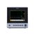 Edan X Series Patient Monitors deliver high-resolution touchscreen displays, advanced ECG and CO₂ monitoring, and seamless EMR connectivity—ideal for dental sedation, surgical suites, and mobile practices. Compact, reliable, and built for compliance.