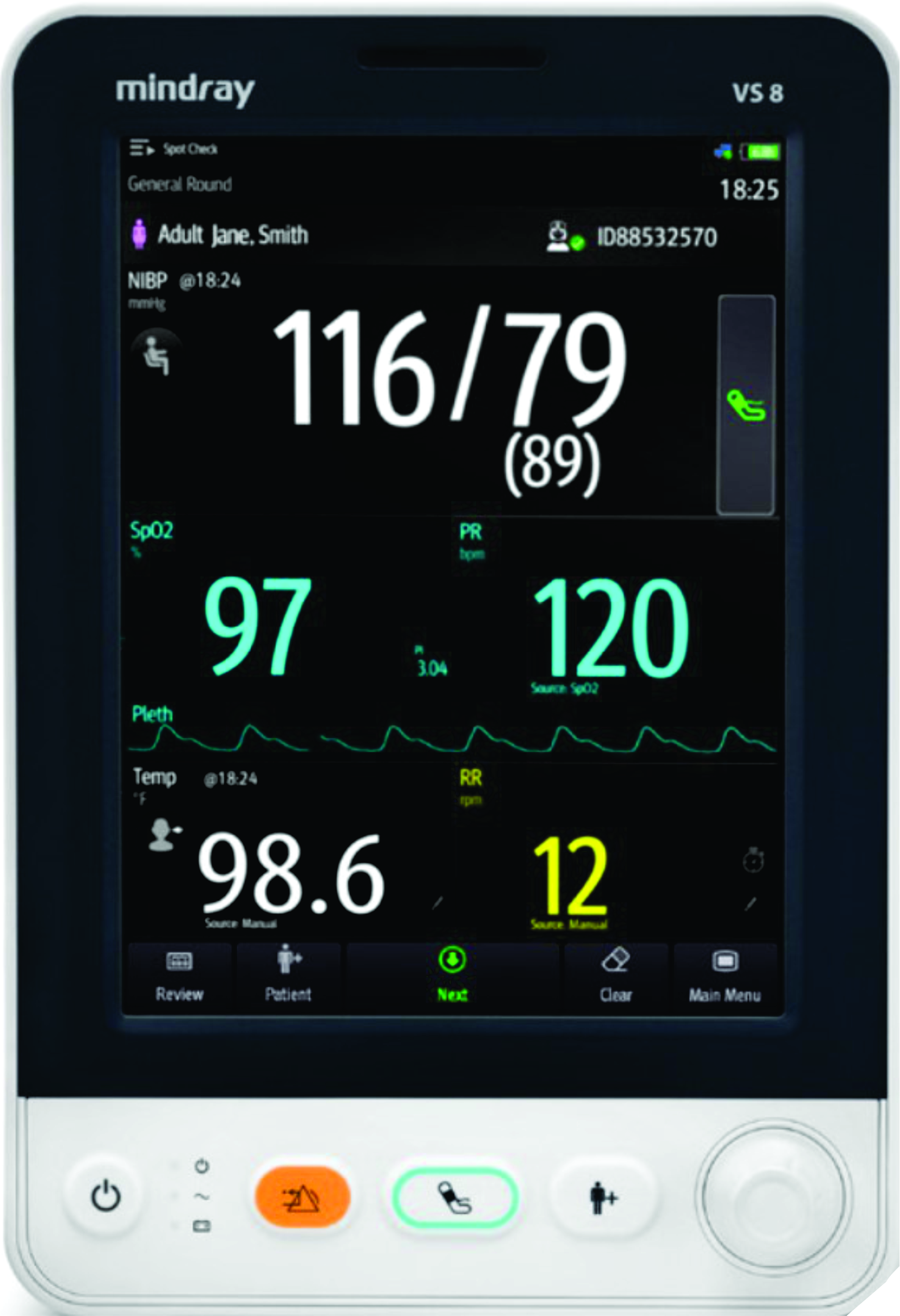 Vital Signs vs Patient Monitors In Your Dental Office