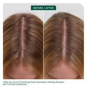 Matrix Biolage Scalp Sync Universal Conditioner 236ml