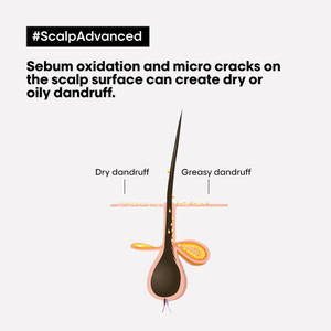 L'Oréal Professionnel Serie Expert Scalp Advanced Anti-Discomfort Shampoo 300ml
