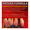 DERMATOLOGY PSORIASIS CREAM