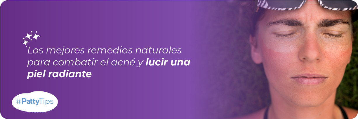 Consejos para recuperar la piel quemada en el verano