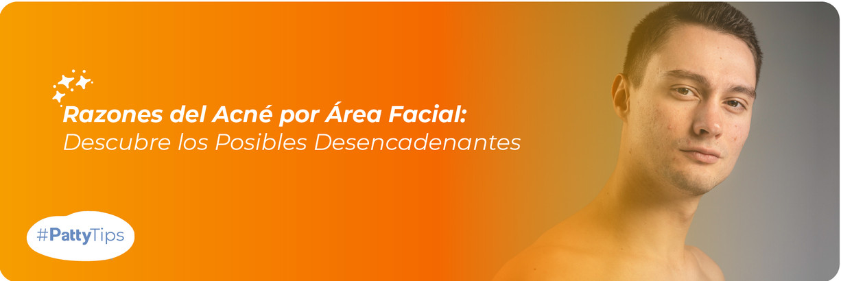 ​Mapa del Acné: Causas Comunes según la Zona