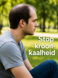 Heren Toupet CR111 V-Loop Skin Kruin Stuk