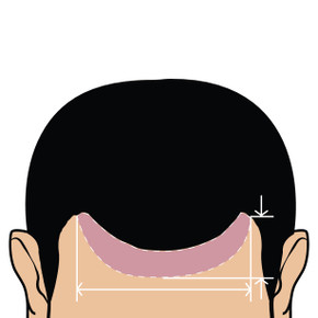 Heren Frontaal haarstukken op maat gemaakte Heren Frontaal haarstukken op maat gemaakte