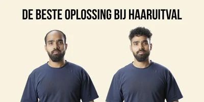 Wat is de beste oplossing bij haaruitval?