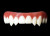 Dental Distortions Immortal FX Fangs 2.0 (out of packaging). Sold by Norcostco. Dental Distortions Immortal FX Fangs 2.0 (out of packaging). Sold by Norcostco.