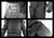 Phenom 6 PX6 Tactical Riot Suit, SKU: PX6 Phenom 6 PX6 Tactical Riot Suit, SKU: PX6