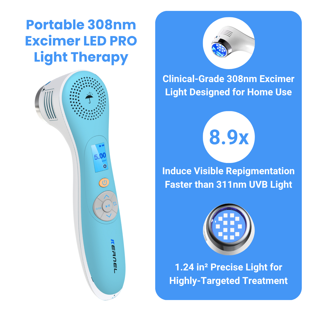 308nm Excimer LED PRO – Advanced UV Therapy for Vitiligo