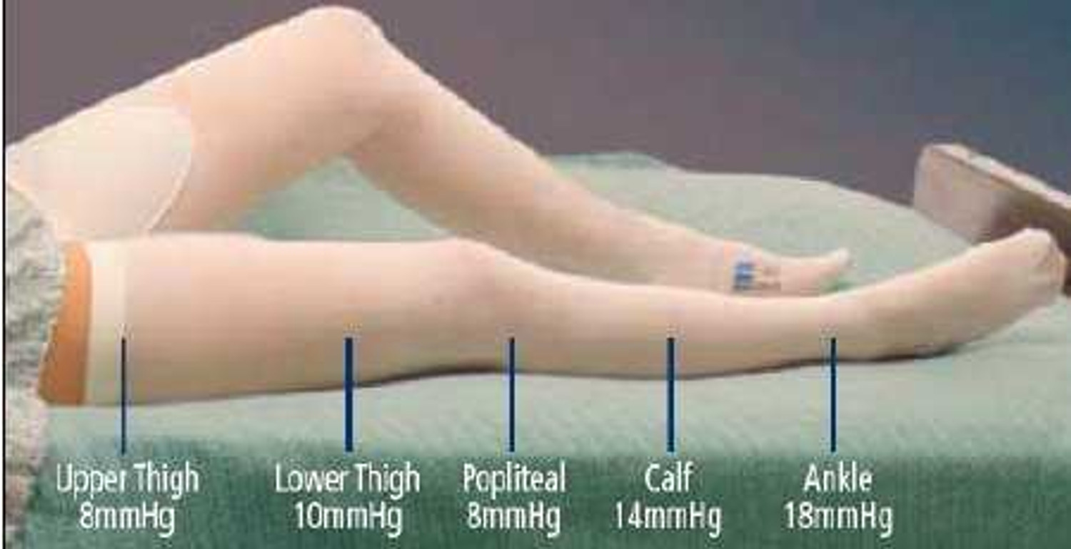 Buy Anti-Embolism Stocking 18Mm Hg Thigh High