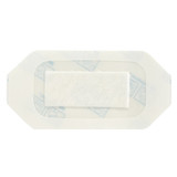 3M Tegaderm Transparent Film Dressing with Pad 2-3/8 X 4 Inch Frame Style Delivery Rectangle Sterile, 3584, Case of 200