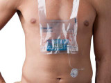 MMT-117 Pack/30 7.07E+13 Medtronic 1142111_PK