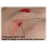Hyfin Vent Compact Chest Wound Seal 4-3/4 X 4-3/4 Inch 2 per Pack NonSterile, 10-0042, Pack of 2