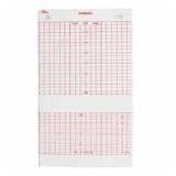 Fetal Diagnostic Monitor Recording Paper Life Trace® Thermal Paper 152 mm x 47 Foot Roll Red Grid B4305AAO Case of 40 B4305AAO Life Trace® 949249_CS