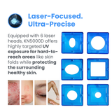 Kernel Excimer Laser 308nm Pro for Clinic Use – Intensity Calibration System Included