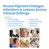 Wood’s Lamp, LED UVA Skin Analyzer with 2X Magnifying Lens & 3-Level White Light KN9000B