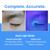 Wood’s Lamp, LED UVA Skin Analyzer with 2X Magnifying Lens & 3-Level White Light KN9000B